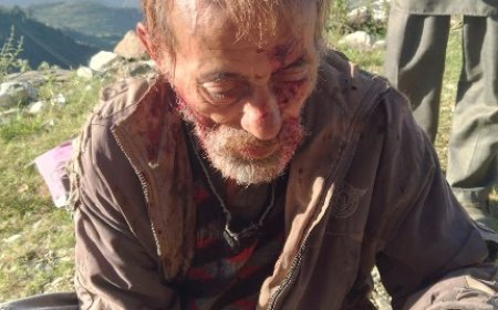 भालू के हमले से घंडुरी के 70 वर्षीय बुजुर्ग बुरी तरह घायल 