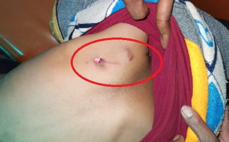 चौपाल  : 5 वर्षीय मासूम बच्ची पर बाघ ने किया हमला,पीठ और कंधे पर गंभीर चोटें