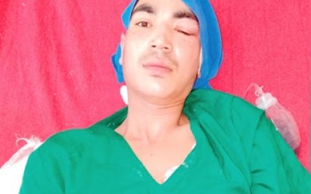 उपलब्धि : कुल्लू की विशेषज्ञ चिकित्सकों की टीम ने न्यूरोसर्जिकल (खोपड़ी की हड्डी) का किया सफल ऑपरेशन 