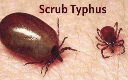 हिमाचल प्रदेश में ‘स्क्रब टाइफस’ की चपेट में आने से अब तक तीन लोगों की मौत