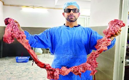 मंडी में बना भारत का सबसे बड़ा मेडिकल रिकार्ड : महिला के गर्भाशय से निकाली 5.21 किलो रसोली 