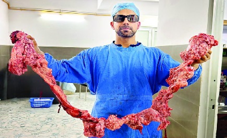 मंडी में बना भारत का सबसे बड़ा मेडिकल रिकार्ड : महिला के गर्भाशय से निकाली 5.21 किलो रसोली 