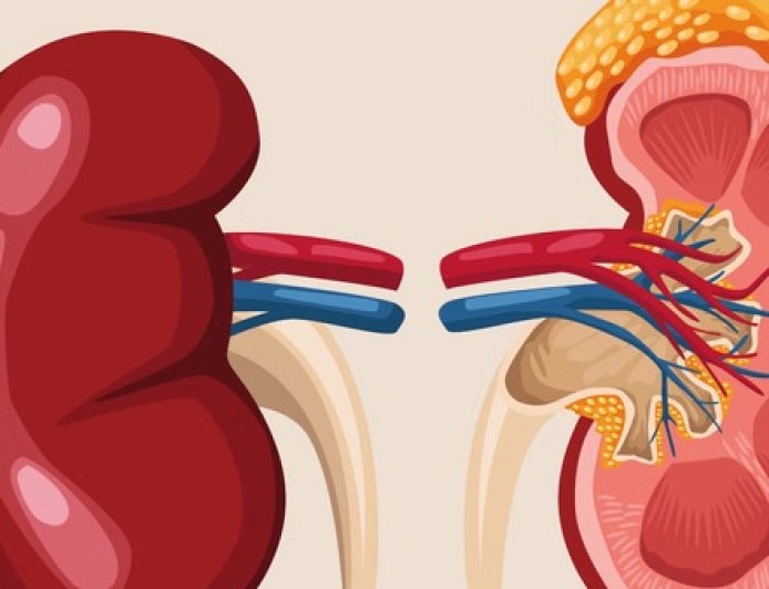 लोगों की बदली जीवनशैली के बीच किडनी के मरीजों की संख्या में हर साल 25 से 30 फीसदी की बढ़ोतरी 