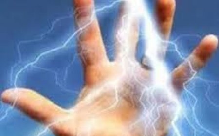 फ्यूज लगाने ट्रांसफार्मर पर चढ़ा प्रशिक्षु करंट लगने से झुलसा